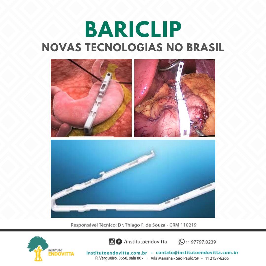 BARICLIP Instituto EndoVitta